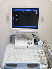 心臓超音波検査